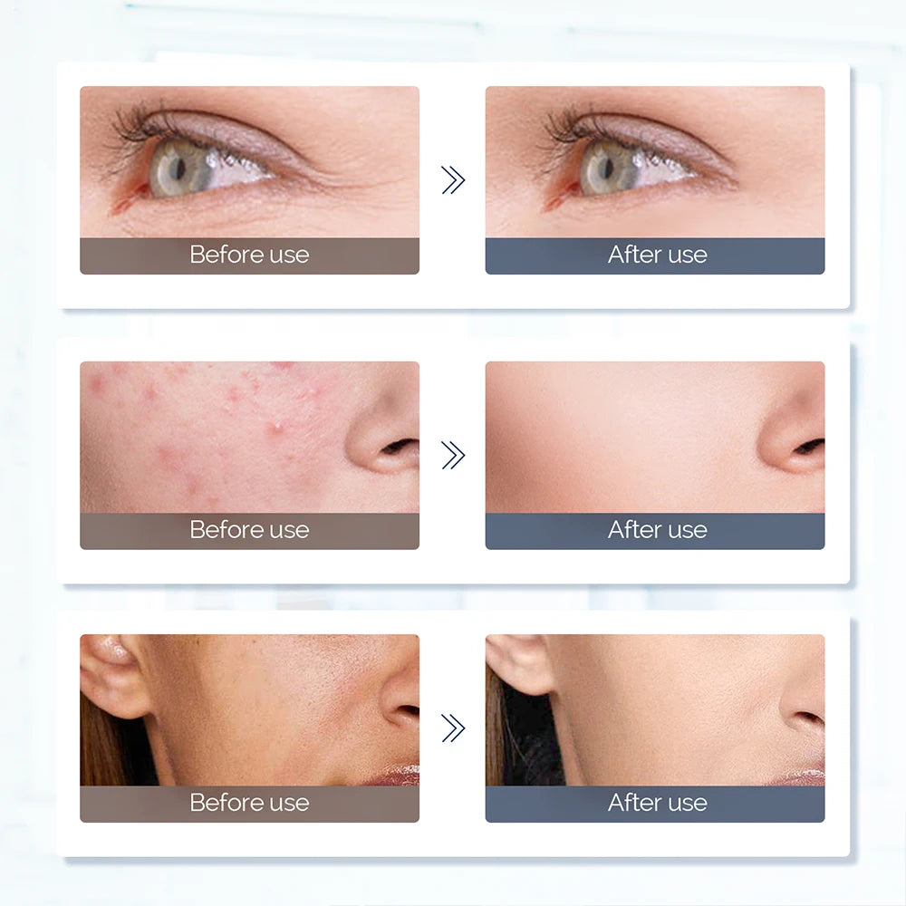 GlowLift Mask – EMS & Ultrasonic Care