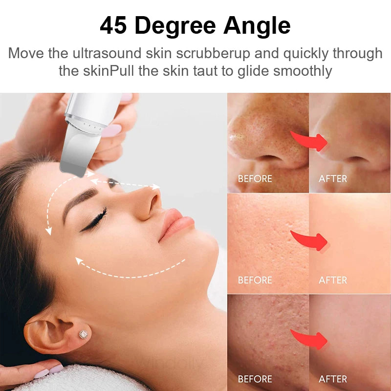 Polish™ — Ultrasonic Skin Scrubber